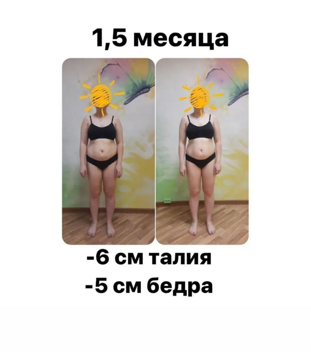 Отёки до и после