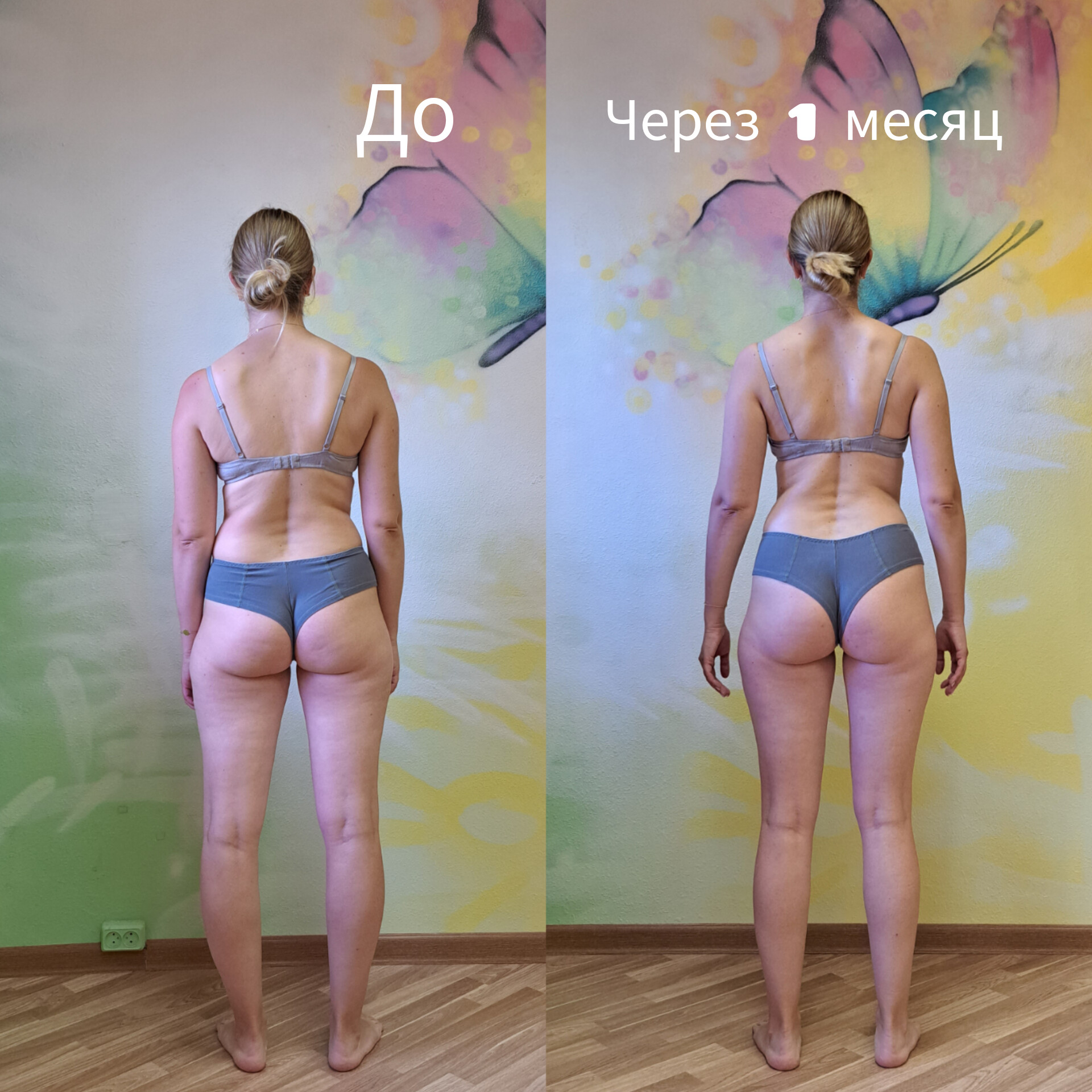 Отёки до и после