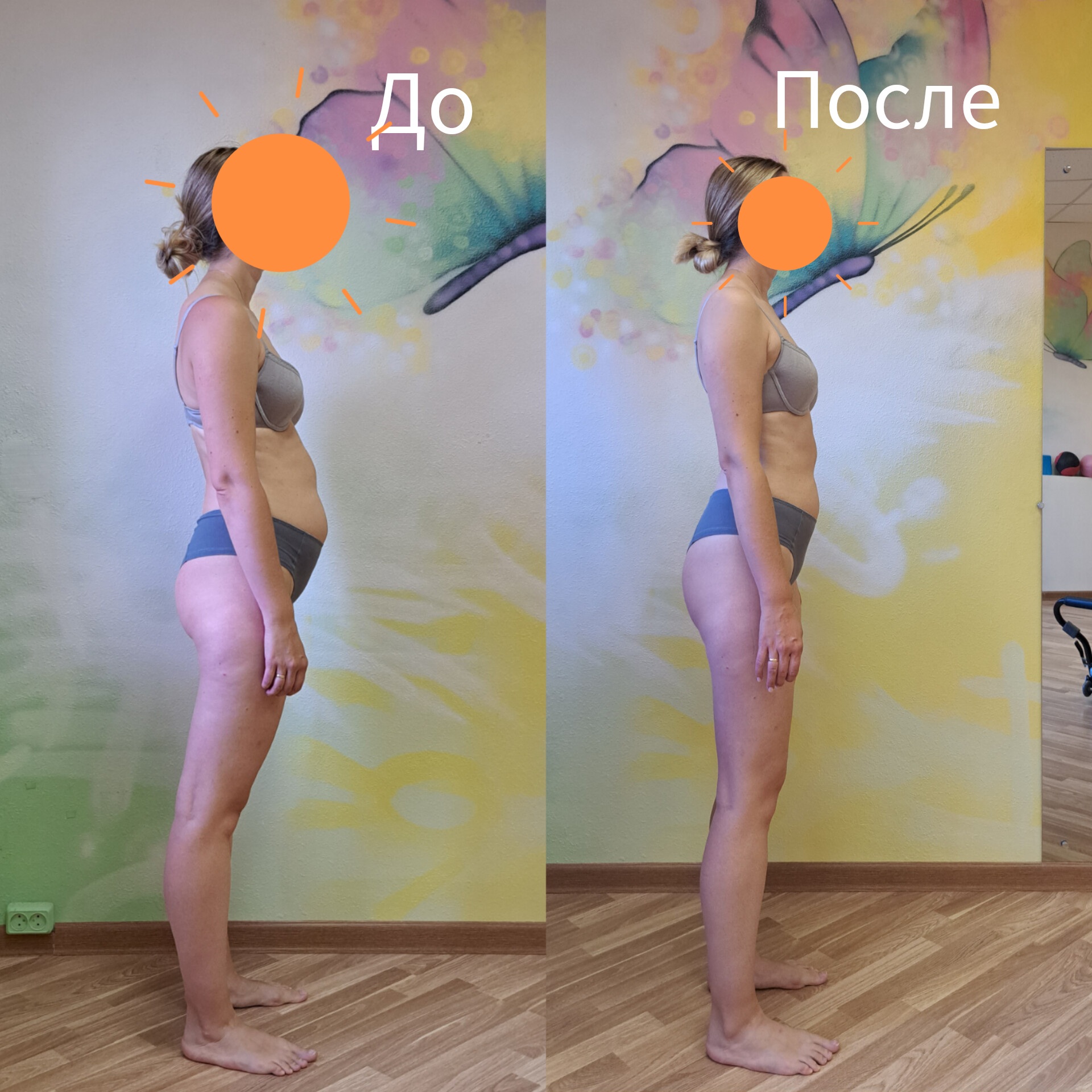 Живот до и после